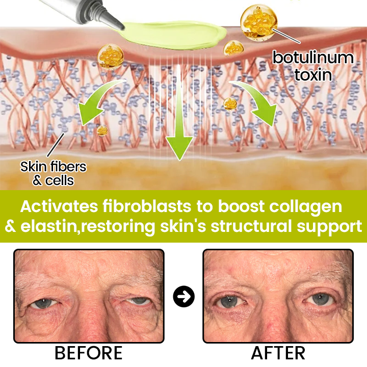 [🔥Last Day 70% OFF] Timilk® Botox & Retinol Shot – Smoother-Looking Skin for Deep Lines, Sagging Jowls & Puffy Eyes