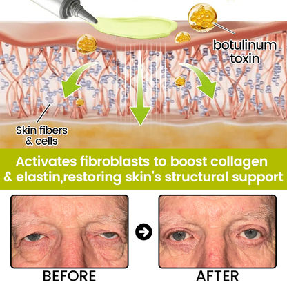 [🔥Last Day 70% OFF] Timilk® Botox & Retinol Shot – Smoother-Looking Skin for Deep Lines, Sagging Jowls & Puffy Eyes