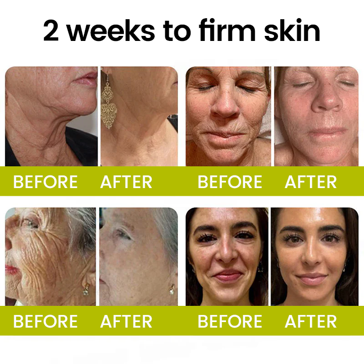 [🔥Last Day 70% OFF] Timilk® Botox & Retinol Shot – Smoother-Looking Skin for Deep Lines, Sagging Jowls & Puffy Eyes