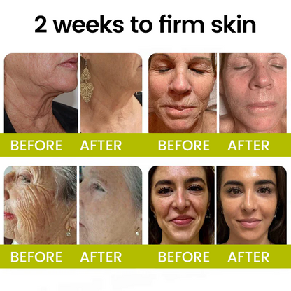[🔥Last Day 70% OFF] Timilk® Botox & Retinol Shot – Smoother-Looking Skin for Deep Lines, Sagging Jowls & Puffy Eyes