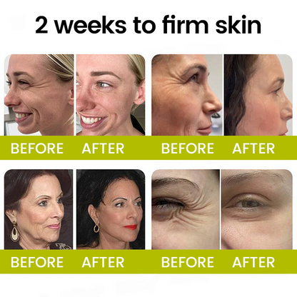 [🔥Last Day 70% OFF] Timilk® Botox & Retinol Shot – Smoother-Looking Skin for Deep Lines, Sagging Jowls & Puffy Eyes
