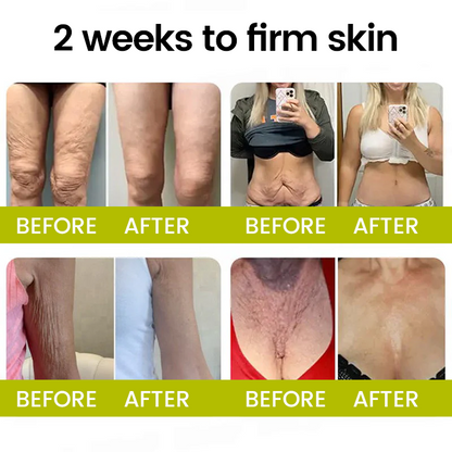 [🔥Last Day 70% OFF] Timilk® Botox & Retinol Shot – Smoother-Looking Skin for Deep Lines, Sagging Jowls & Puffy Eyes